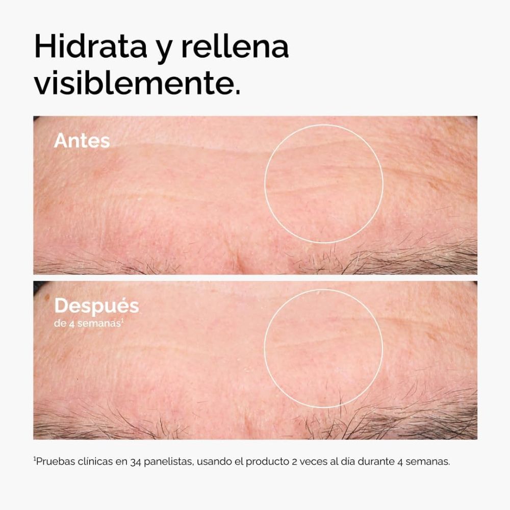 &Aacute;CIDO HIALUR&Oacute;NICO 2%+B5 Y CERAMIDAS S&Eacute;RUM (S&Eacute;RUM HIDRATANTE FACIAL)
